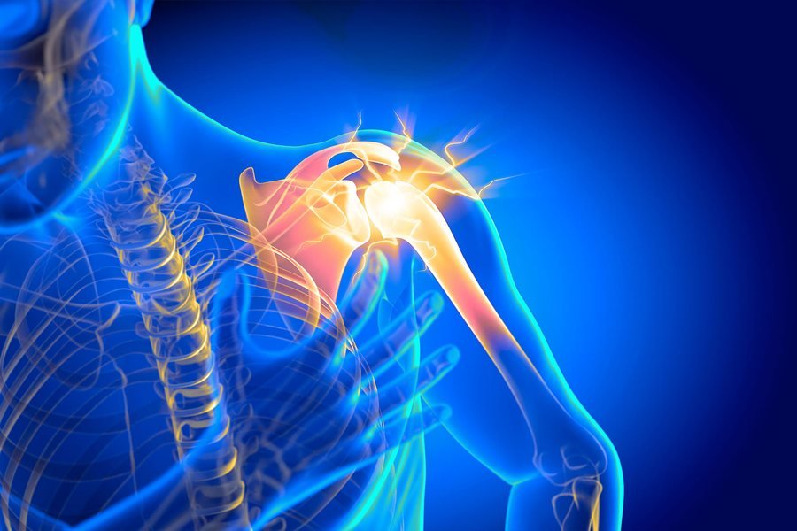 Shoulder pain